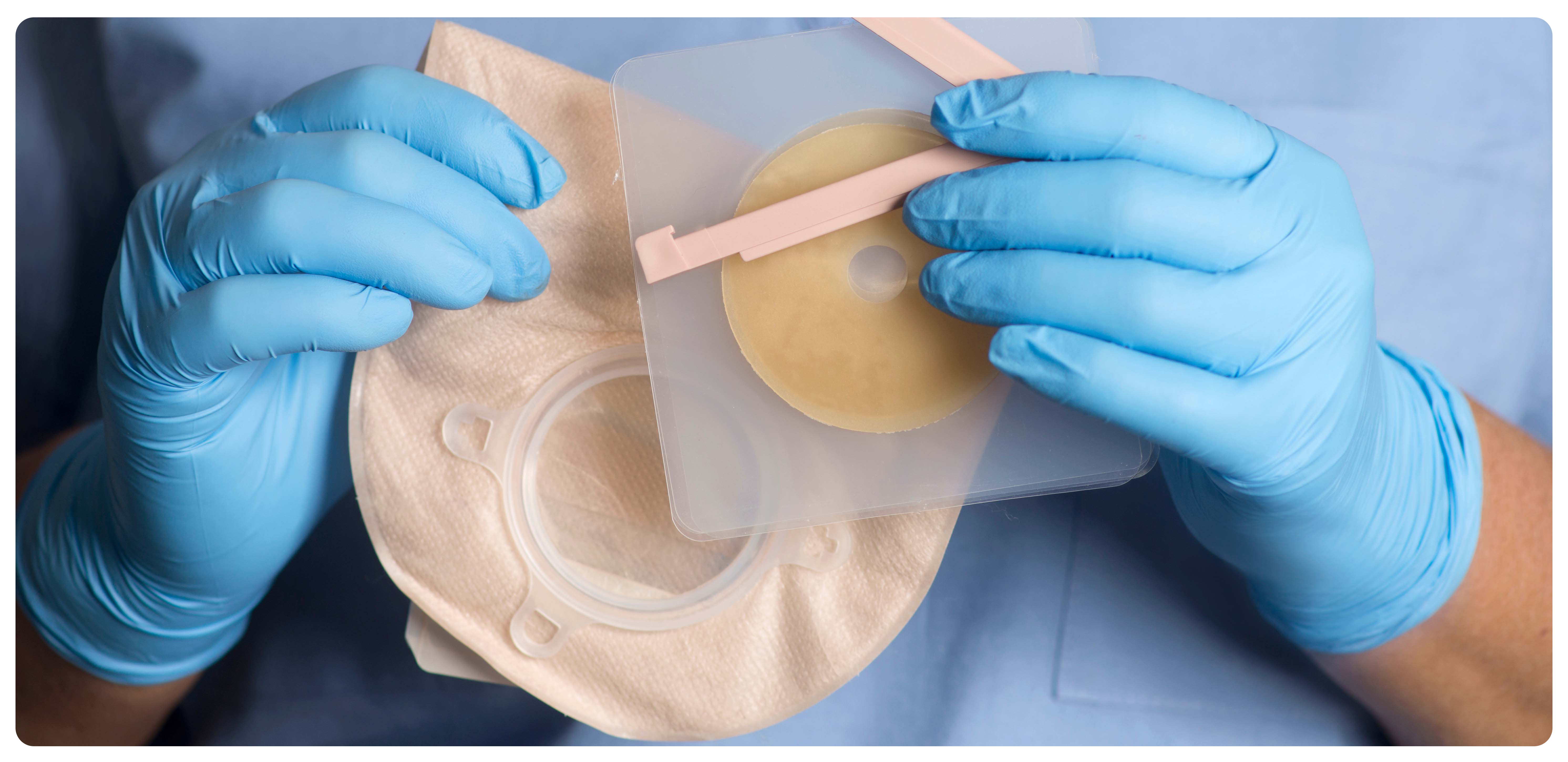 Ostomy supplies in gloved hands